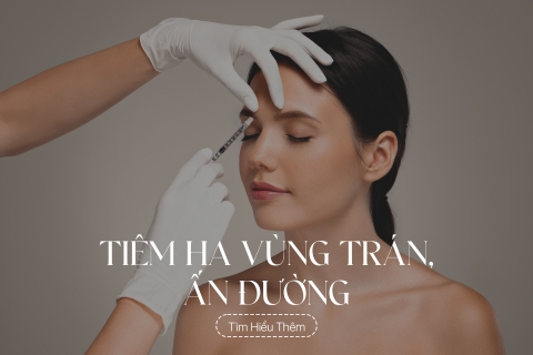 Tiêm Botox vùng trán (ấn đường)
